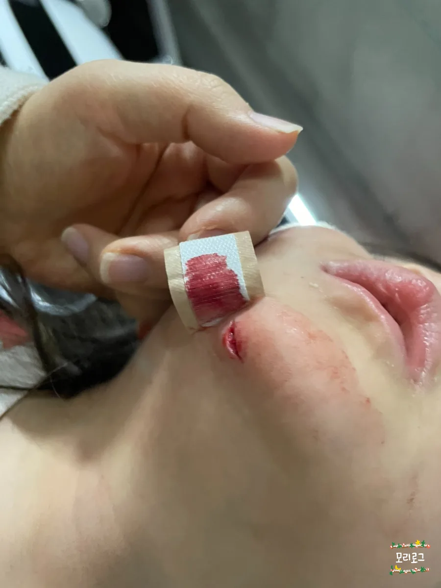아기 상처 봉합 수술 후기: 현대해상 보험청구까지 2026 2