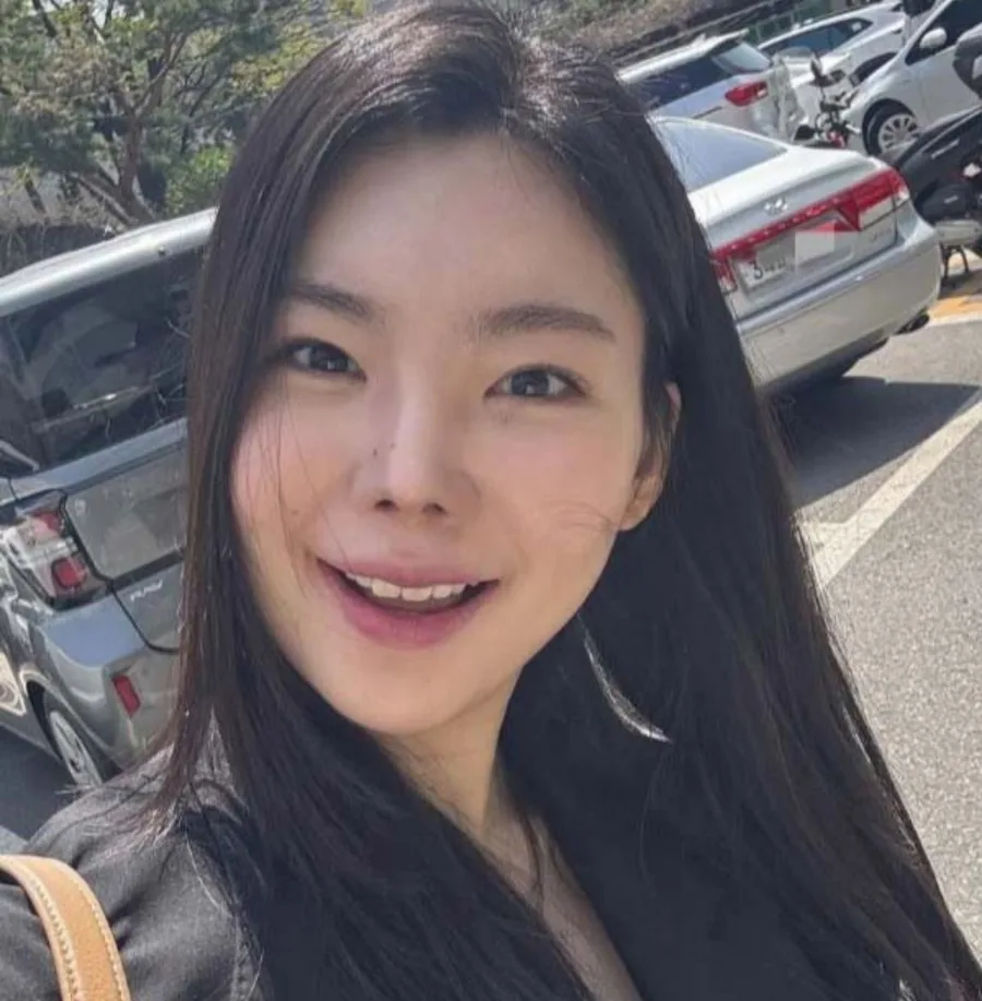 이다은 녹내장 진단, 라식 불가 이유는? 눈 건강 관리법 2026 2