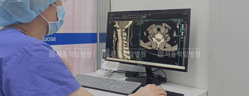 경추관협착증 수술 기준 2026: 목디스크와 다른 점, 경험자 정리 2