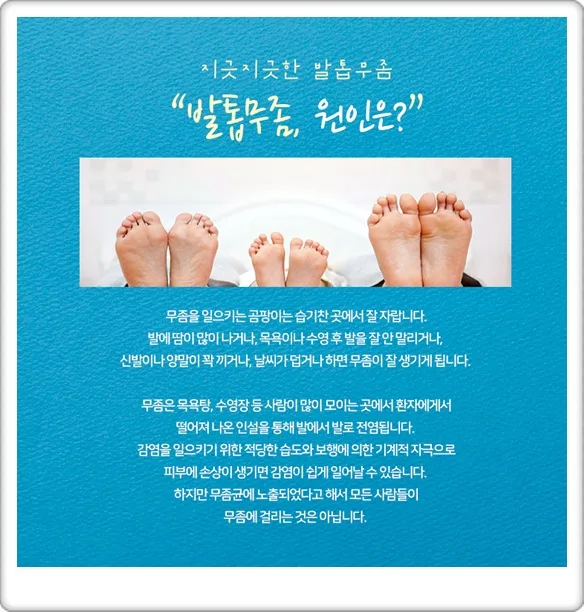 발톱 무좀 치료, 2026년 시작해야 하는 이유와 방법 총정리 2