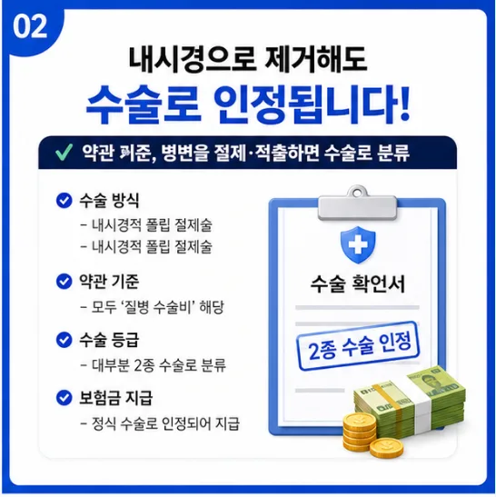 대장내시경 용종 제거 보험금 청구, 2026년 최대 300만원 받는 법 2