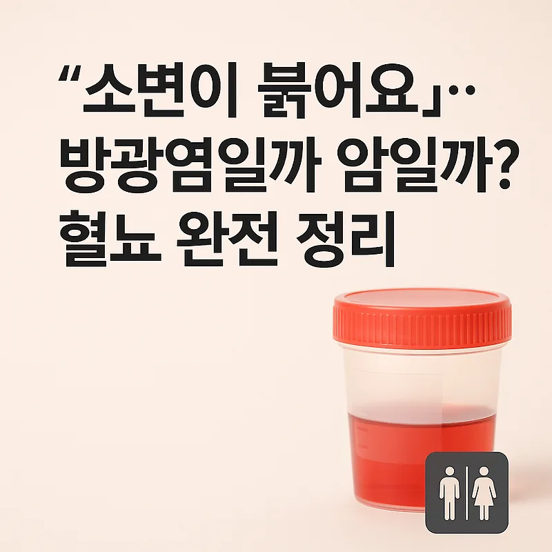 혈뇨 원인과 증상: 방광염 vs 암, 2026년 전문가가 총정리 — 건강·의학 — by 딴따라닭