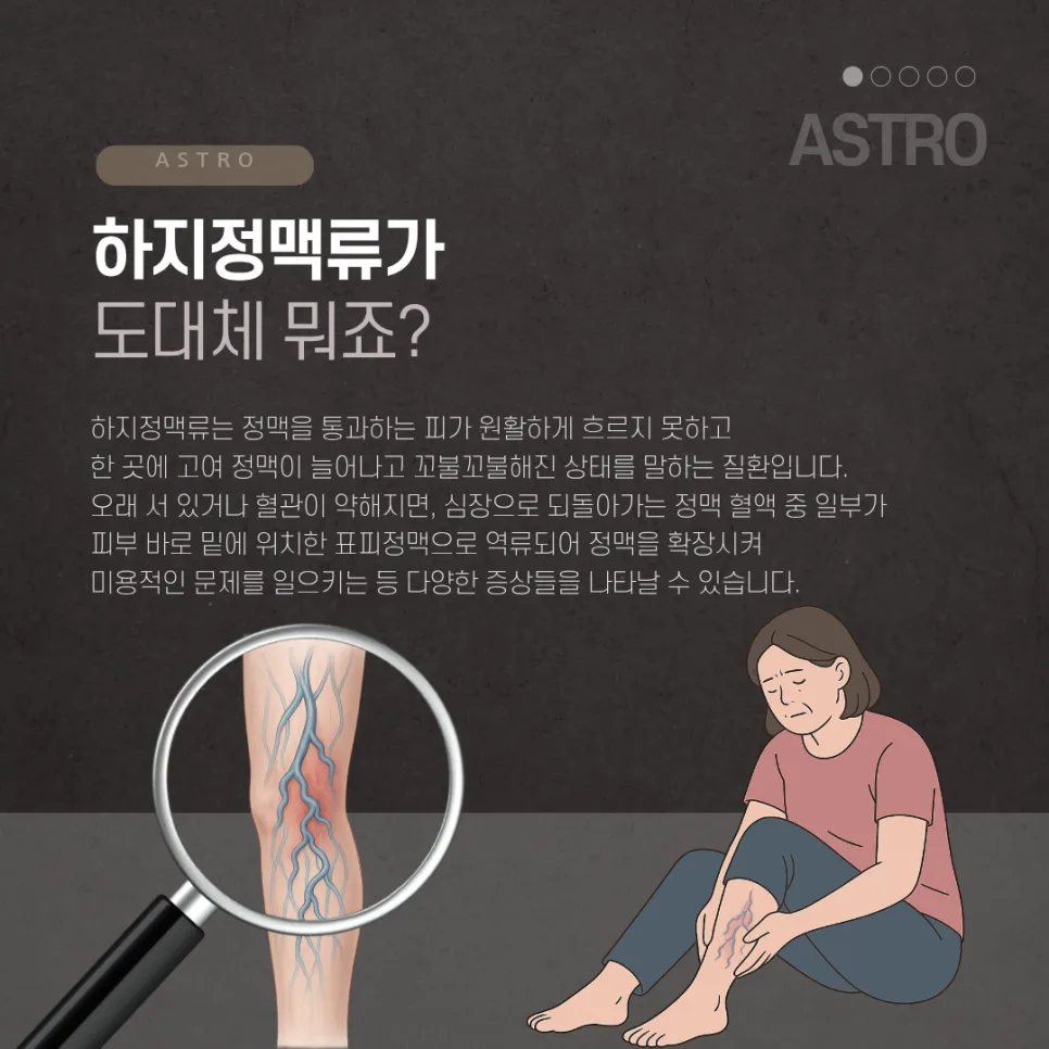하지정맥류 방치 시 위험성 2026: 증상, 원인, 예방 총정리 2