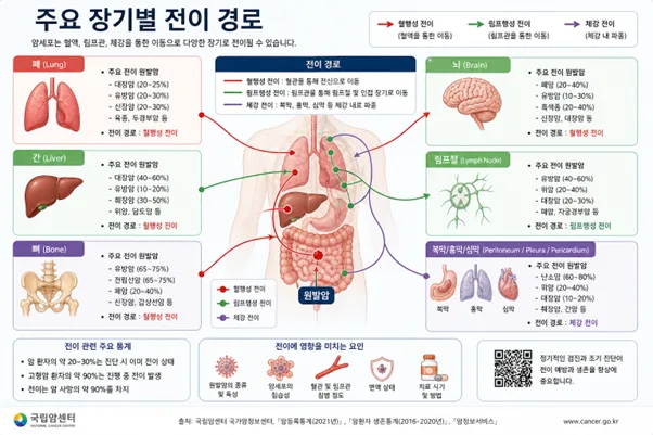 2026년 암보험, 전이암까지 보장받는 통합암보험 필수인가요? 2