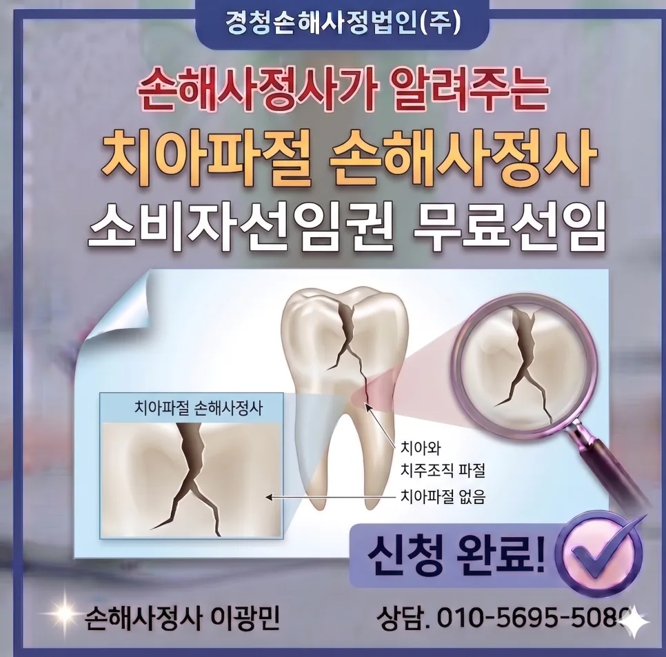 치아파절 보험금 2026: 소비자 선임권으로 무료 손해사정 받는 법 — 비즈니스·경제 — mpmpon2