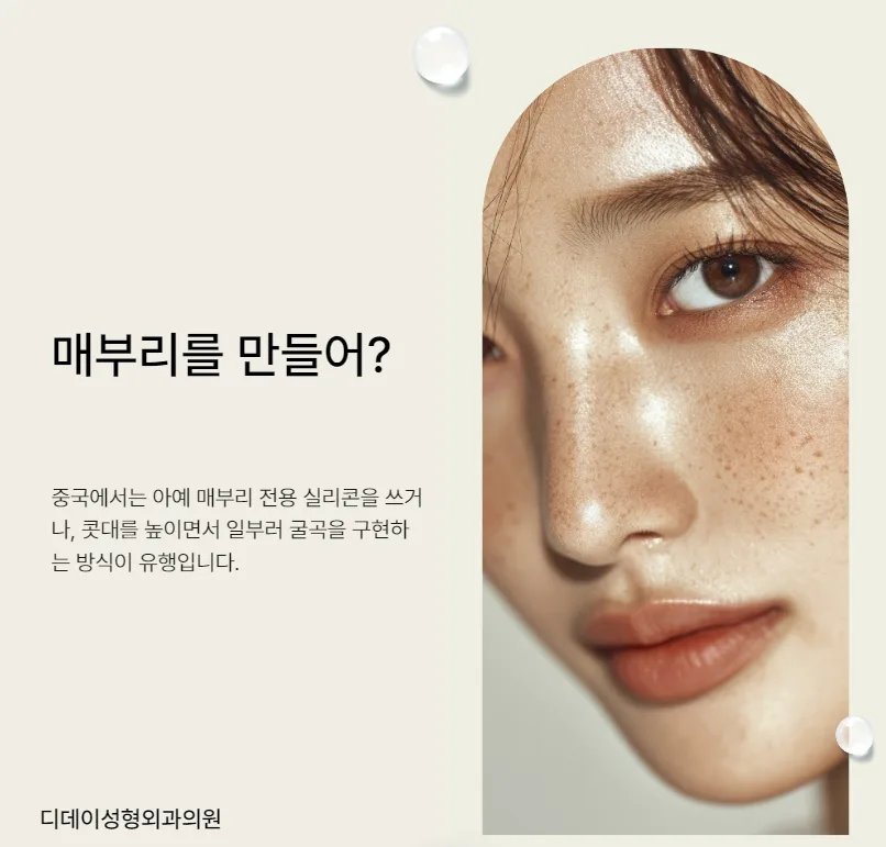매부리코 성형, 오히려 만드는 트렌드 2026년 분석 2