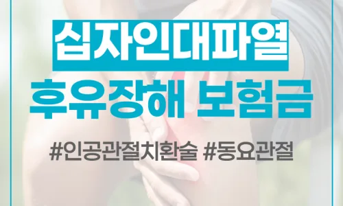 경골 고평부 골절 & 십자인대 파열: 후유장해 보험금 2026년 완벽 가이드 3