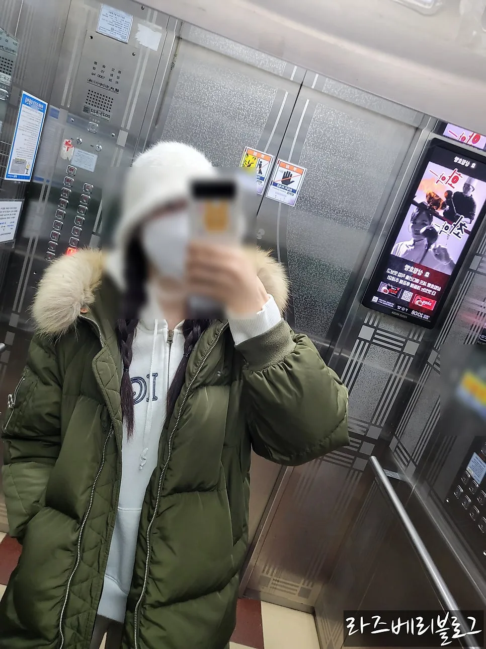 뇌수막종 감마나이프 6개월 후기: 손 저림, 두통, 구토 증상 완화 2026 2