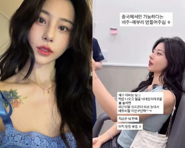노슬비 코 성형 후기 2026: 붓기 관리와 솔직한 심경 변화 — 스타·아이돌 — ddongddong111 1
