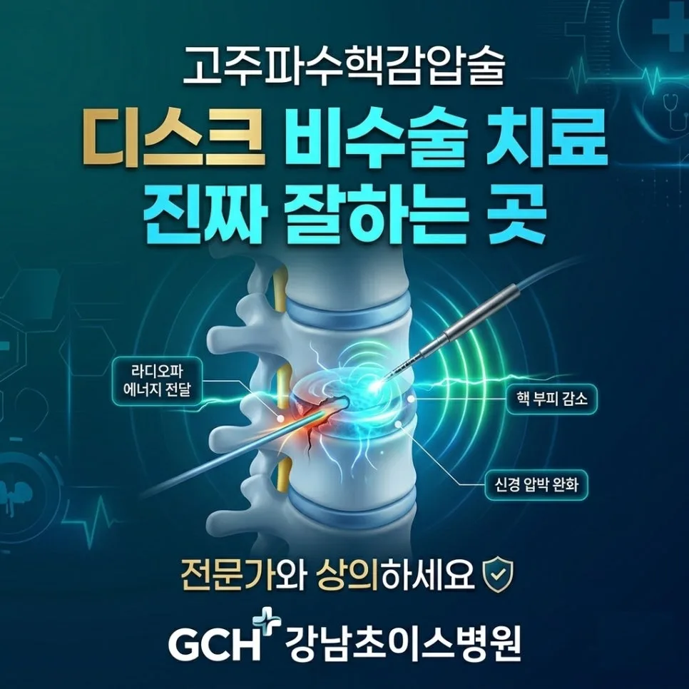 고주파수핵감압술 효과, 정말 없을까? 2026년 팩트체크 — 건강·의학 — choiceskin