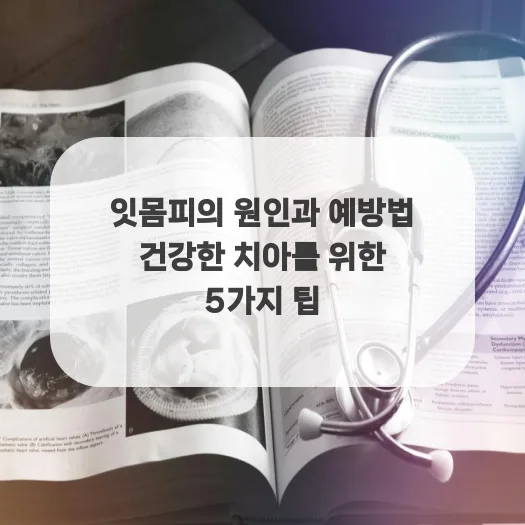 잇몸에서 피 나는 이유와 예방법 2026년 총정리 — 건강·의학 — ruru_lala_