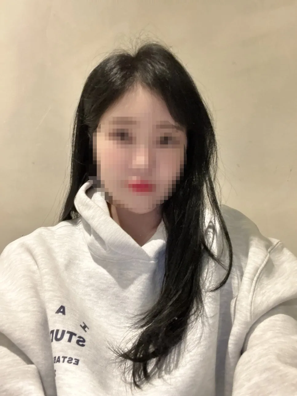 건대 포텐자 바디팻프리주사 2026년 후기: 피부 탄력 & 바디 라인 개선 효과 3