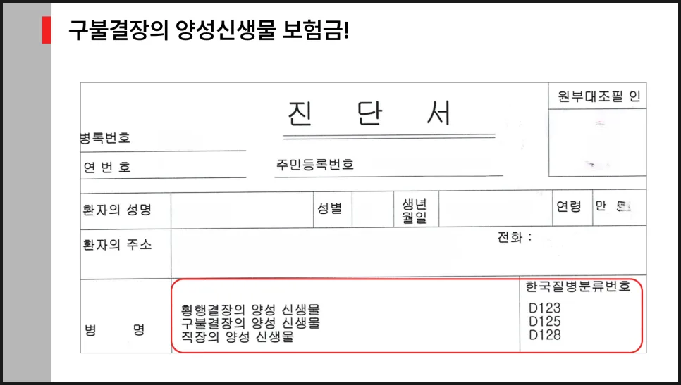 D12.5코드 제자리암 진단비, High grade dysplasia로 2026년 보상받는 법 2