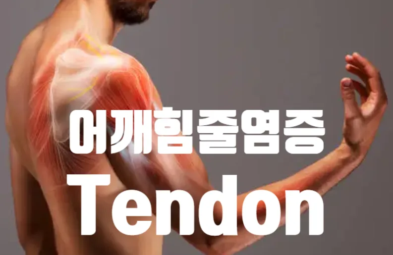 어깨 힘줄 염증 회복 더딘 이유와 해결책 2026년 총정리
