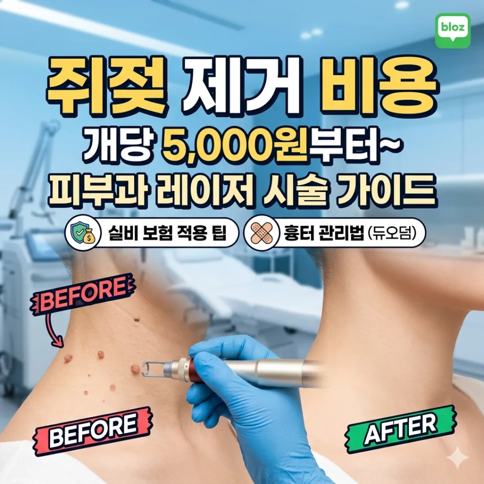 쥐젖 제거 비용 2026년 피부과 시술 총정리 및 흉터 예방법 — 건강·의학 — galviman