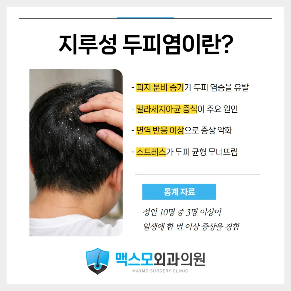 지루성두피염 진물·딱지 치료 2026: 병원 관리법 총정리 2