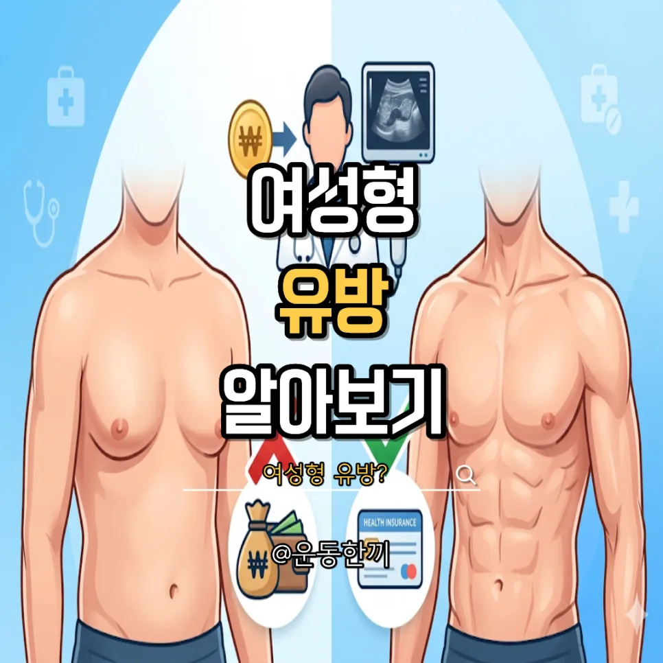 여성형 유방증 치료, 수술비와 보험 적용까지 2026년 완벽 정리 — 건강·의학 — is_workout