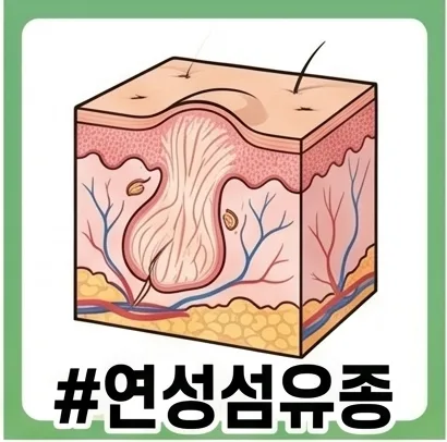 쥐젖 제거, 민간요법 대신 안전한 방법 2026년 총정리 3