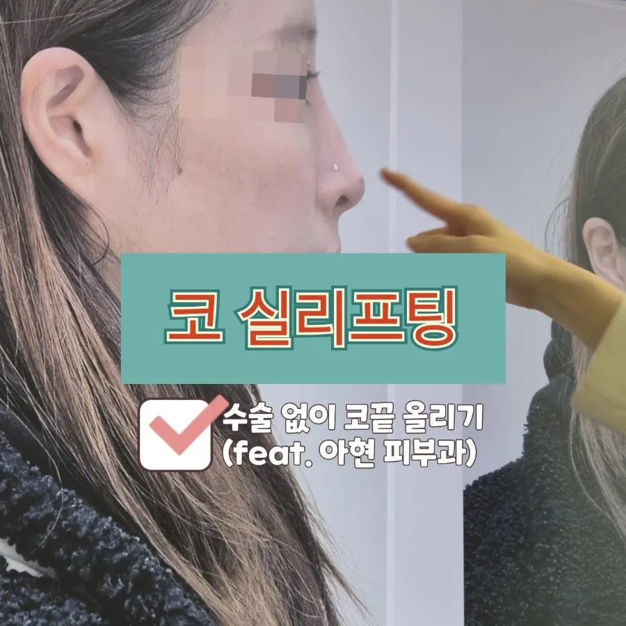 아현역 코 실리프팅 2026: 수술 없이 자연스러운 코 만들기 — 건강·의학 — srm0428