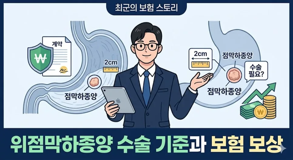 위점막하종양 수술 기준 및 보험 보상 2026년 총정리