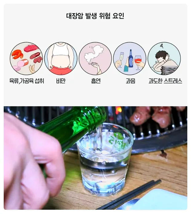 젊은 대장암 세계 1위 원인과 예방법 2026년 총정리 3