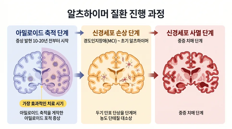 2026년 알츠하이머 치매약, 부모님께 맞을 수 있을까? 핵심 정리 2
