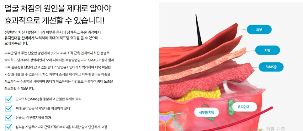 안면거상수술 2026년, 스마스 박리 중요성과 만족도 높이는 법 3