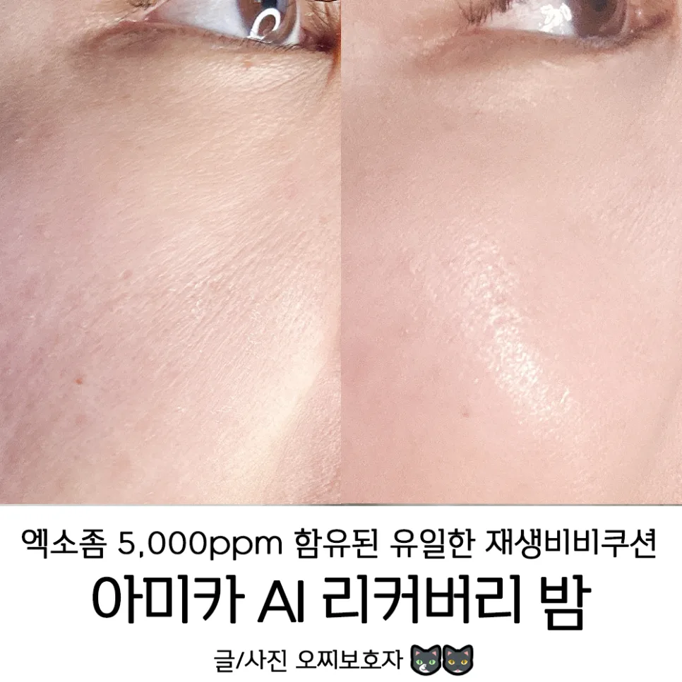 바르고 자는 재생비비 쿠션, 아미카 AI 리커버리 밤 효과 2026