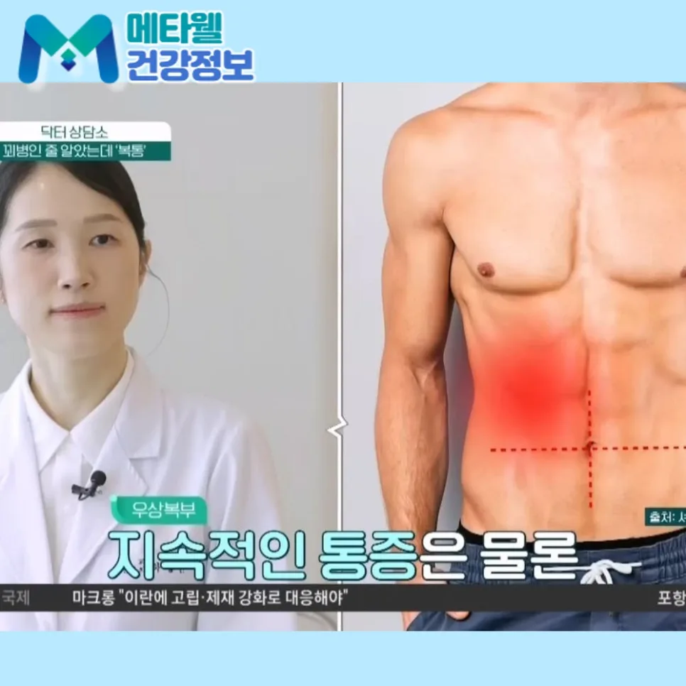여자 배꼽 통증 원인 5가지와 응급 신호 2026년 총정리 — 건강·의학 — metaph_official