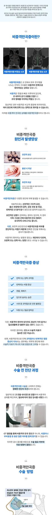 비중격 만곡증 수술 2026: 콧물 해결 위한 최신 정보 총정리 — 건강·의학 — rub51760