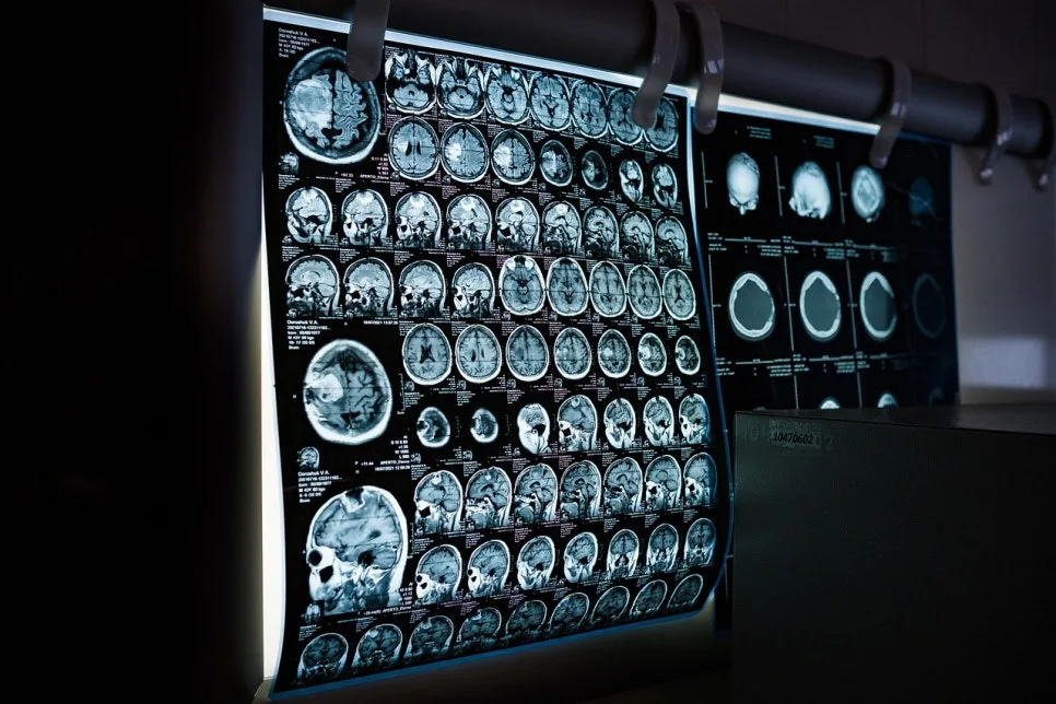 MRI 보험 청구 서류 완벽 준비 가이드 2026 2