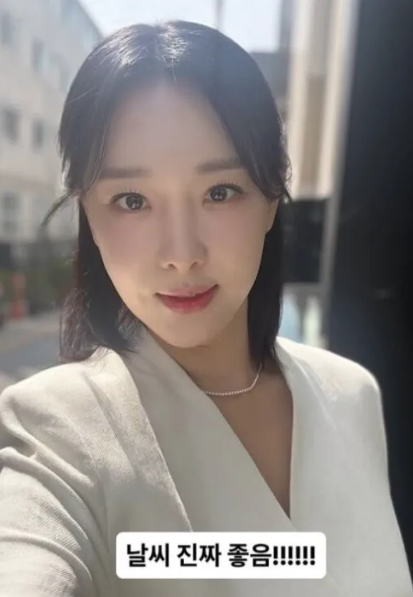 이지혜 인중 축소술 후기 2026: 콤플렉스 극복과 솔직 고백