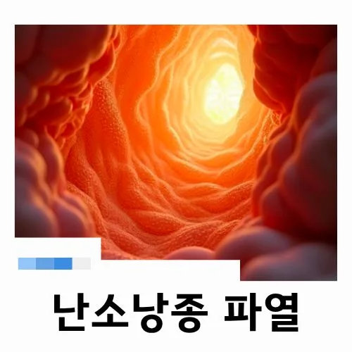 난소낭종 파열 응급 증상과 수술, 2026년 최신 정보 총정리 — 건강·의학 — lovelym87